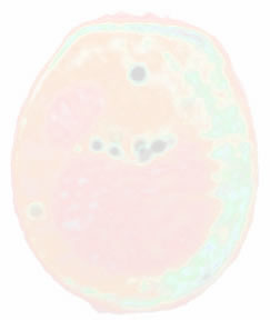 yeast cell